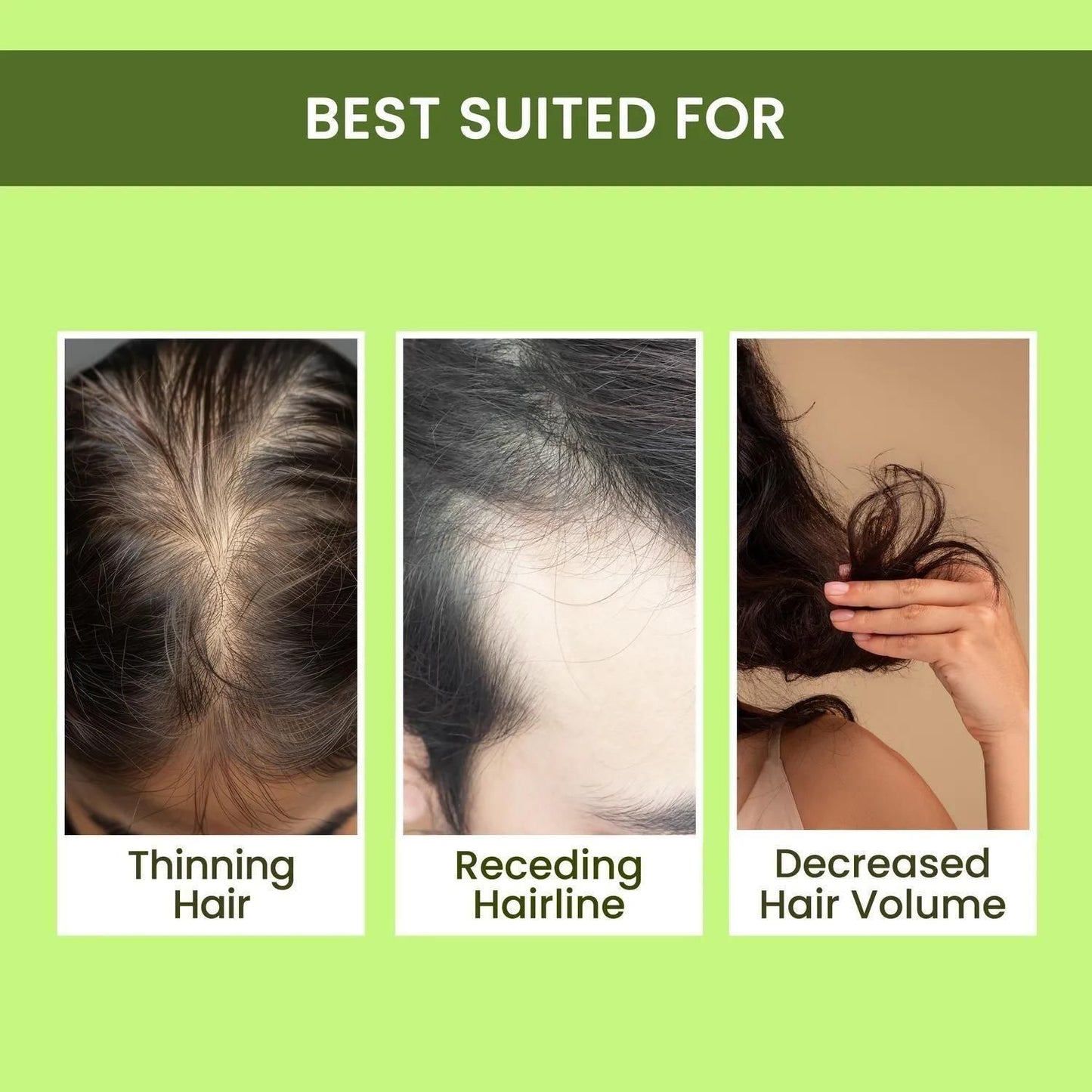 Rosemary Water, Hair Spray For Regrowth ð¥Buy 1 Get 2 Freeð¥